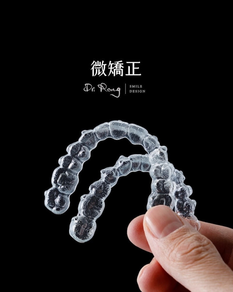​前牙美學療程-微矯正