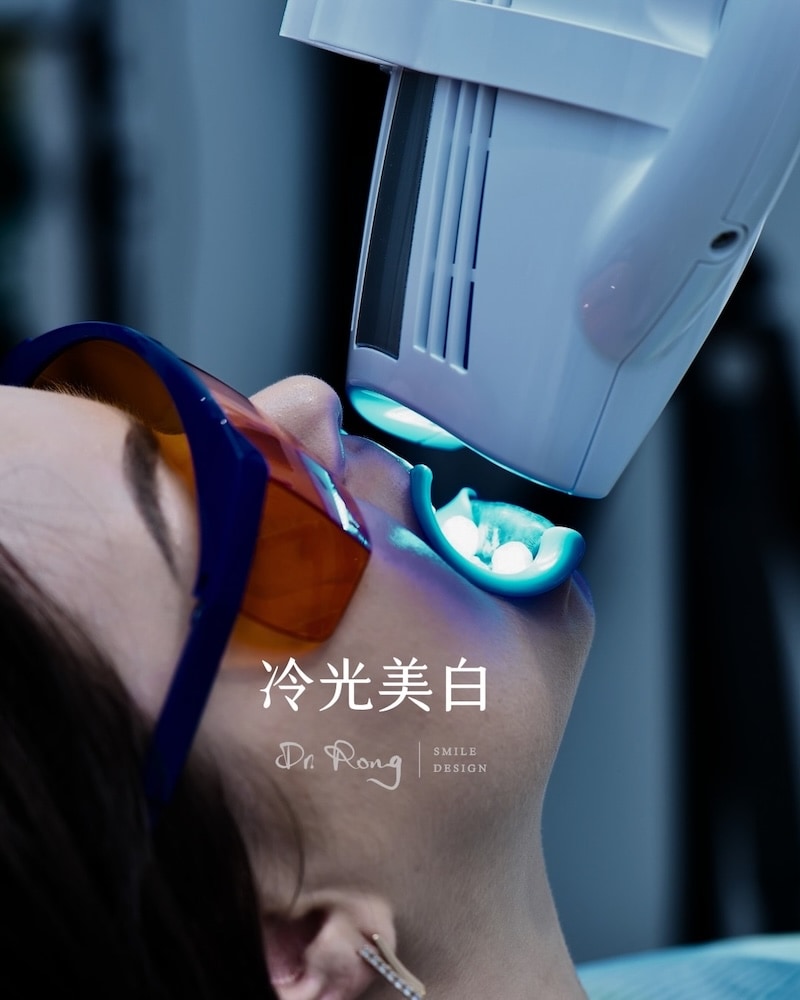 輔助牙科美容療程-冷光美白