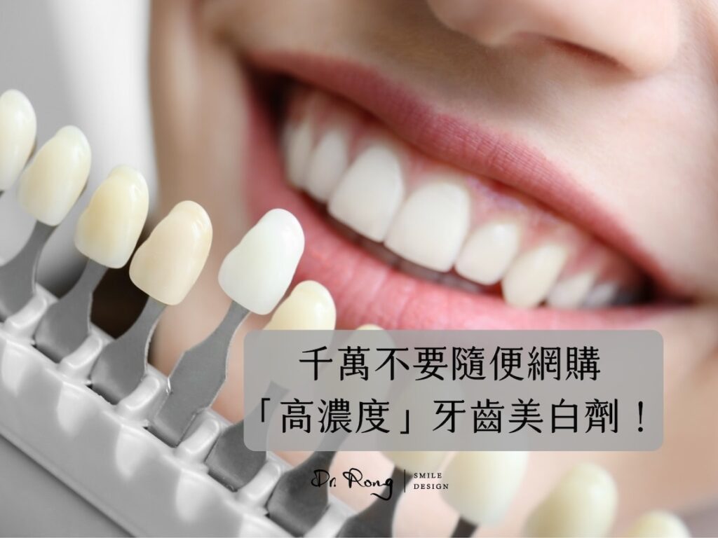 牙齒美白-dcard-ptt-居家美白-台北牙齒美白-推薦-許家榕醫師