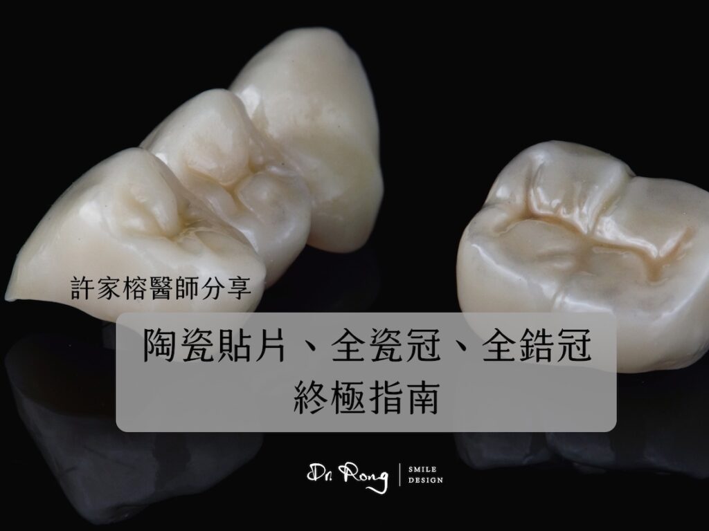 陶瓷貼片-全瓷冠-全鋯冠-壽命-費用-優缺點-推薦-台北-許家榕醫師