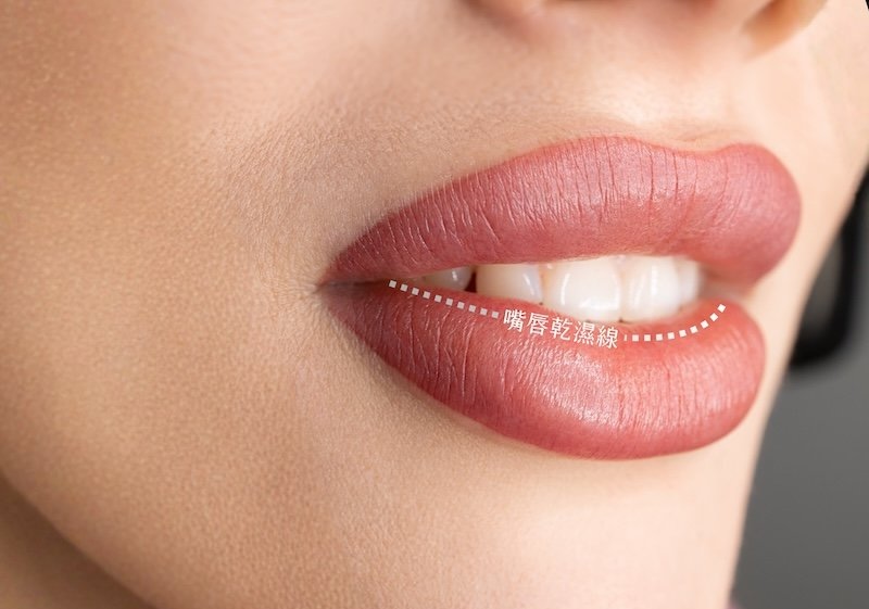 牙齒前後位置與嘴唇乾濕交界線關係的側面示意圖