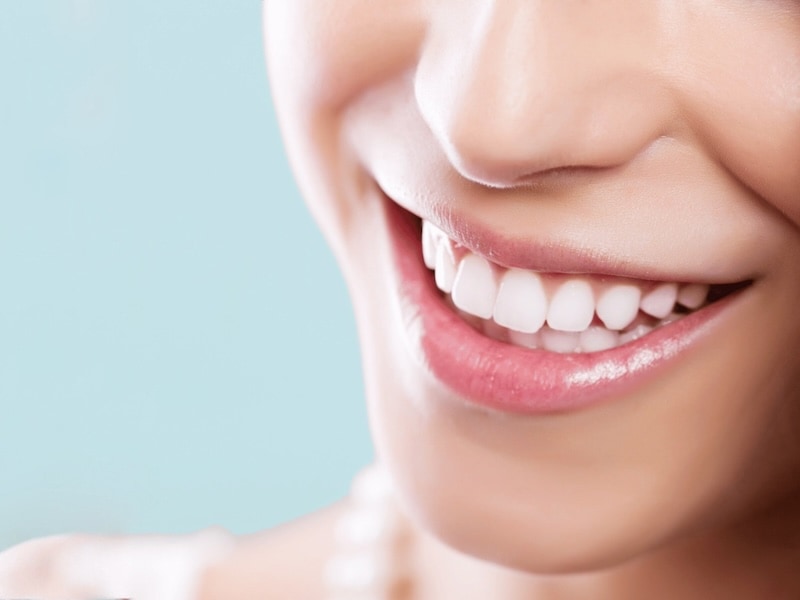 牙齒微笑曲線示意圖