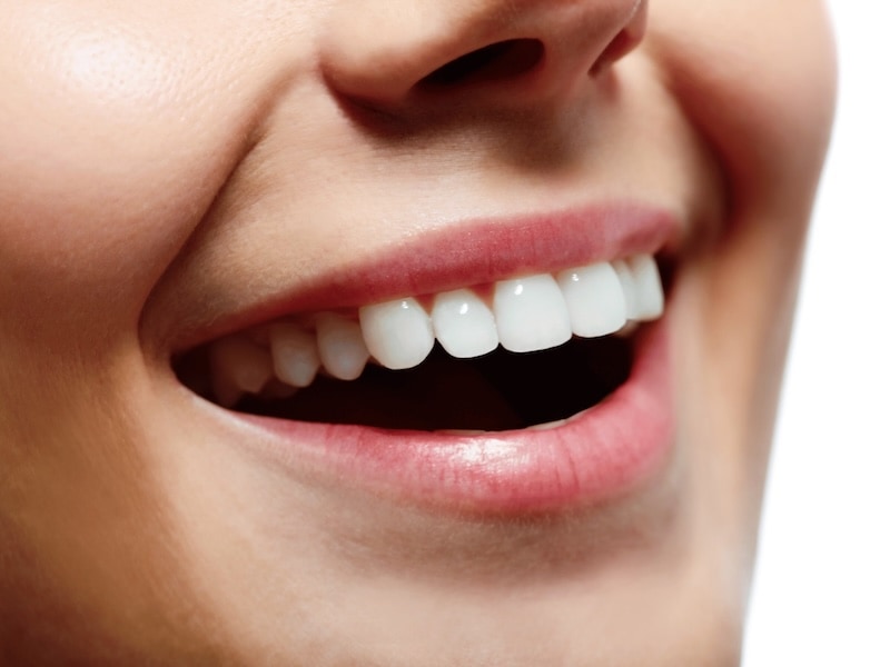 牙齒微笑曲線示意圖