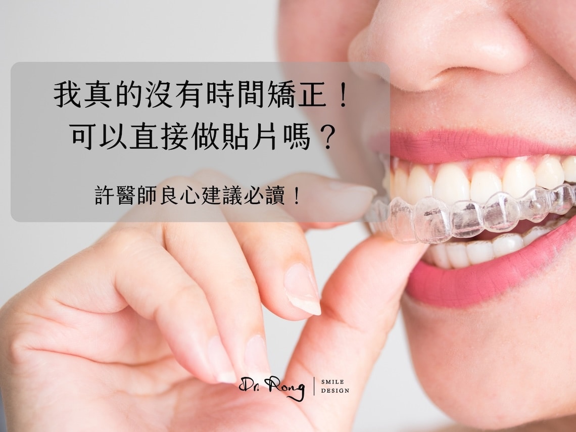 牙齒亂可以不矯正做陶瓷貼片嗎-許家榕醫師-台北