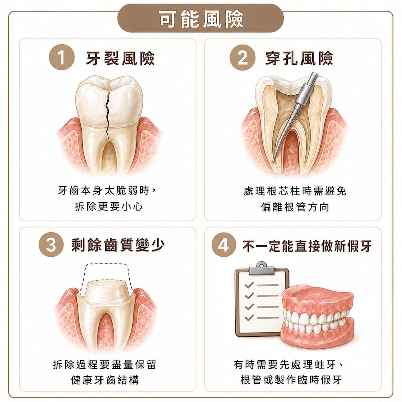 拆假牙風險示意圖，包含牙裂、牙根穿孔、剩餘齒質變少與無法直接重做假牙等常見問題
