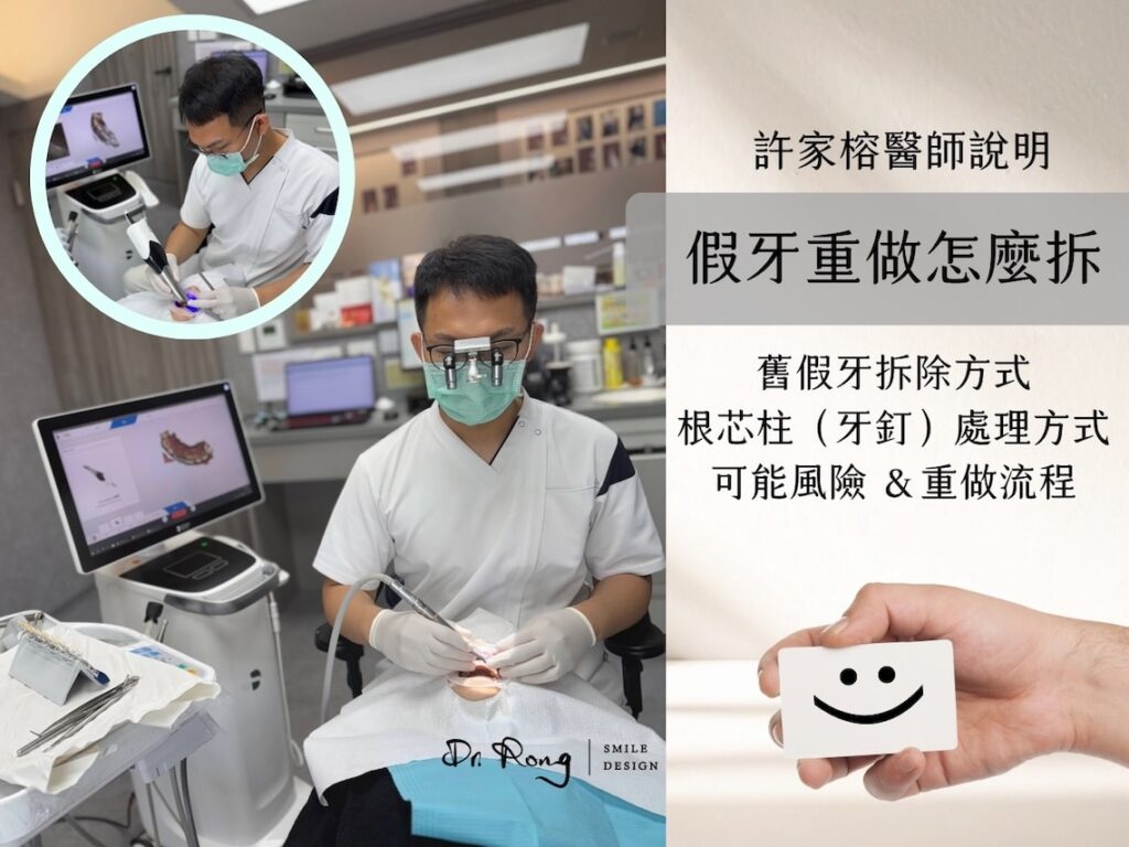 假牙拆除-假牙重做-拆假牙-風險-許家榕醫師-台北